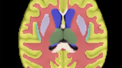 A Baboon Brain Atlas for Magnetic Resonance Imaging and Positron Emission Tomography Image Analysis featured image