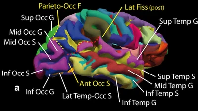A practical guide for the identification of major sulcogyral structures of the human cortex featured image