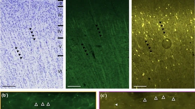 Cytoarchitecture and myeloarchitecture of the sheep auditory cortex featured image
