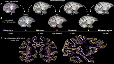 Longitudinal MRI template of the baboon brain from birth to adolescence featured image