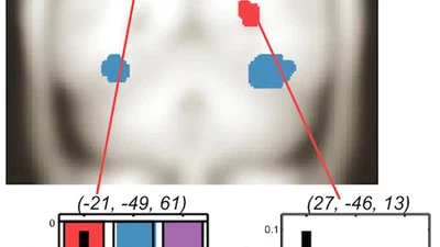 Cerebral Correlates and Statistical Criteria of Cross-Modal Face and Voice Integration featured image