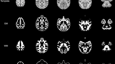 The average baboon brain: MRI templates and tissue probability maps from 89 individuals featured image