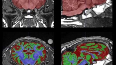 Maternal deprivation and milk replacement affect the integrity of gray and white matter in the developing lamb brain featured image