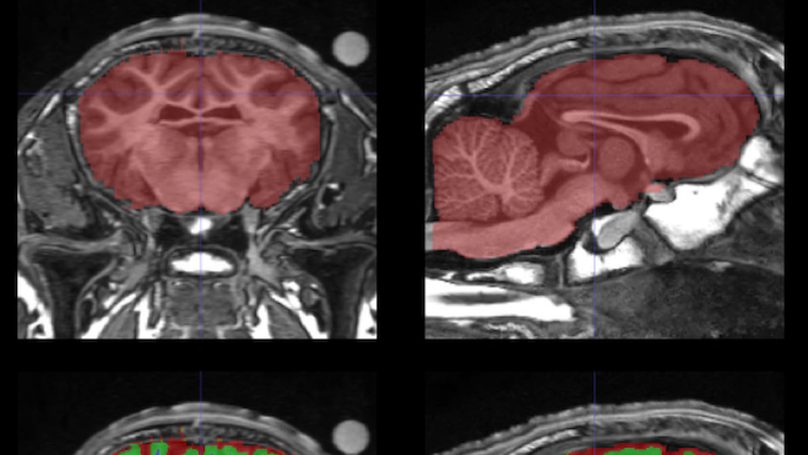 Maternal deprivation and milk replacement affect the integrity of gray and white matter in the developing lamb brain